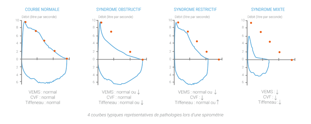 dessins spirometrie