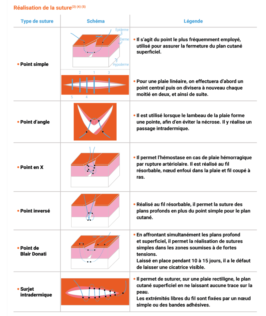 Tableau Réalisation de la suture